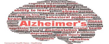 Consumer Health News - Healthday: Could a New Drug Help Ease Alzheimer's?